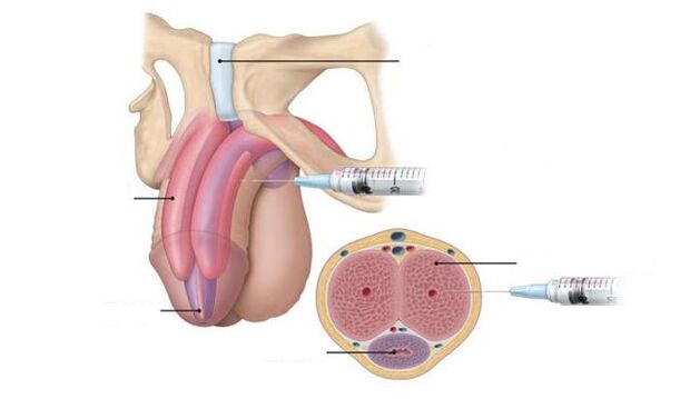 injections to improve strength